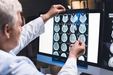 doctor looking at brain scans of concussion
